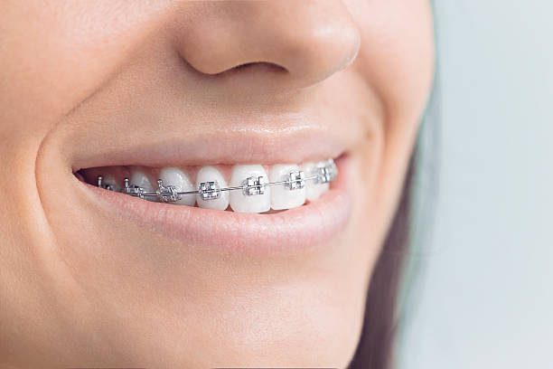 Best Teeth Whitening  in Wewa, OK